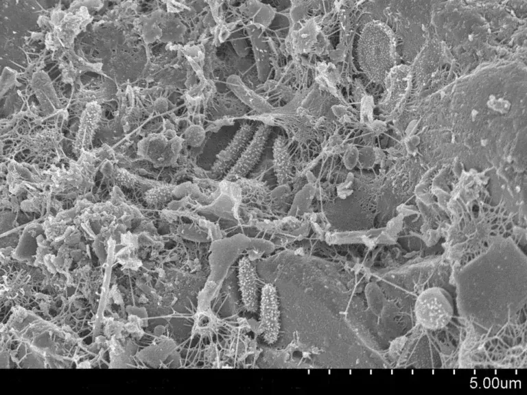 Understanding the Hantavirus: Assessing Risks Amidst Rising Public Concern