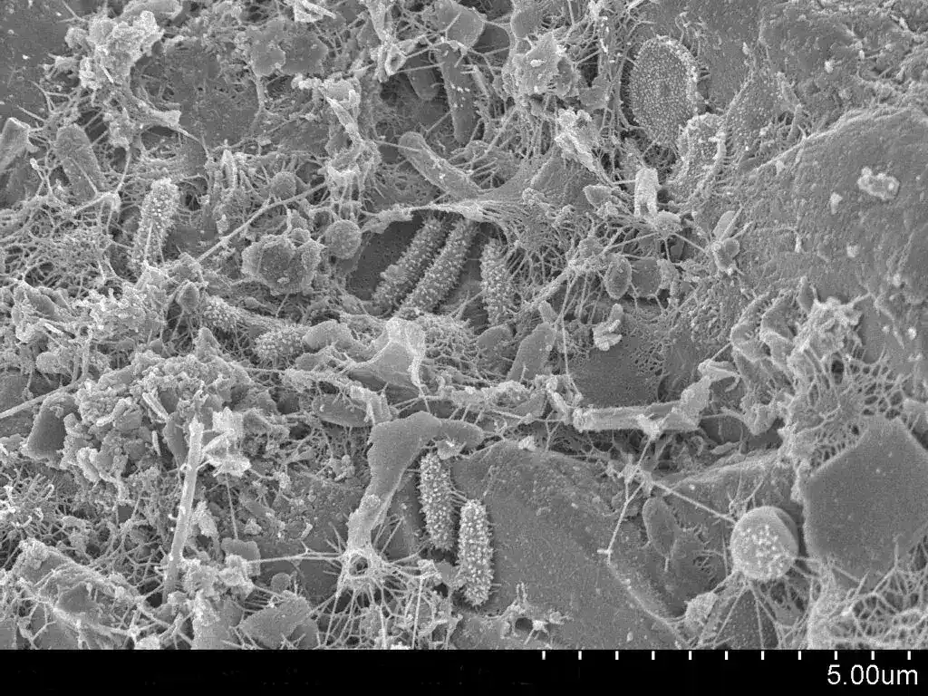 Understanding the Hantavirus: Assessing Risks Amidst Rising Public Concern