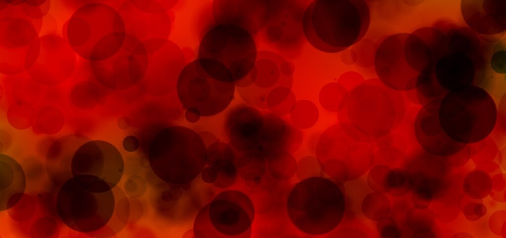 Liquid Biopsies: The New Frontier in Cancer Recurrence Detection
