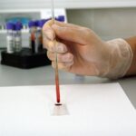 The Rise of Wastewater Surveillance: Monitoring Public Health Through Sewage