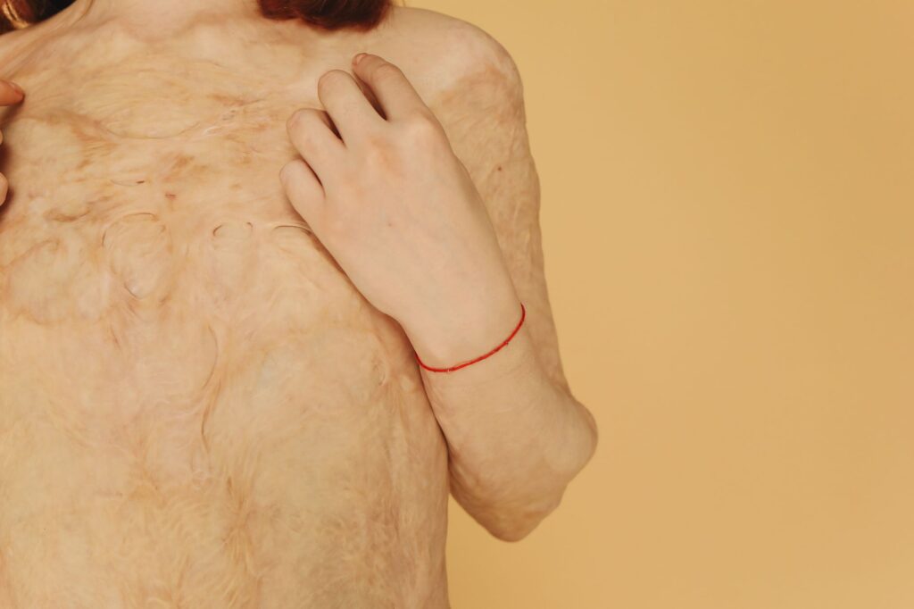 Close-up portrait of a resilient burn survivor showcasing healing and strength.