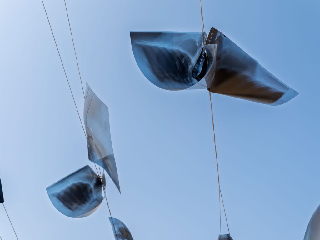 Unique installation of x-ray images suspended against a clear blue sky.