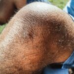 Detailed close-up of an injured knee with a bruise, captured outdoors in natural light.