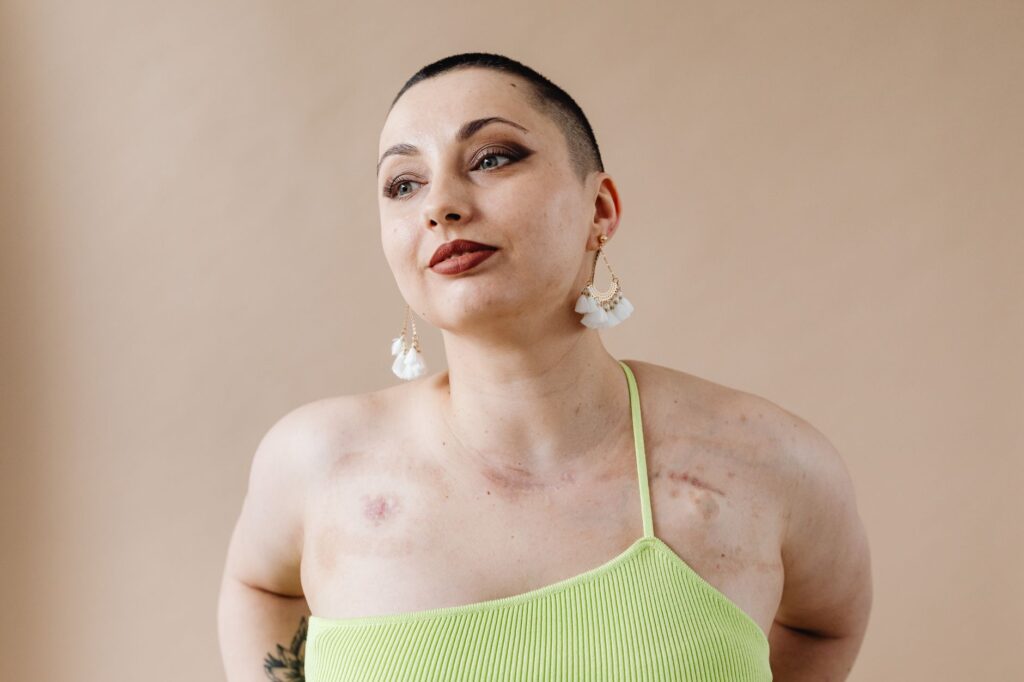 Elegant portrait showcasing a confident woman with earrings and unique beauty marks, highlighting strength.