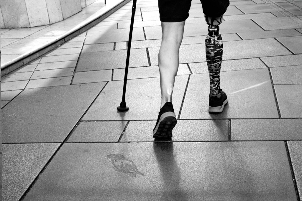 A person with a prosthetic leg walking confidently, symbolizing resilience and determination.