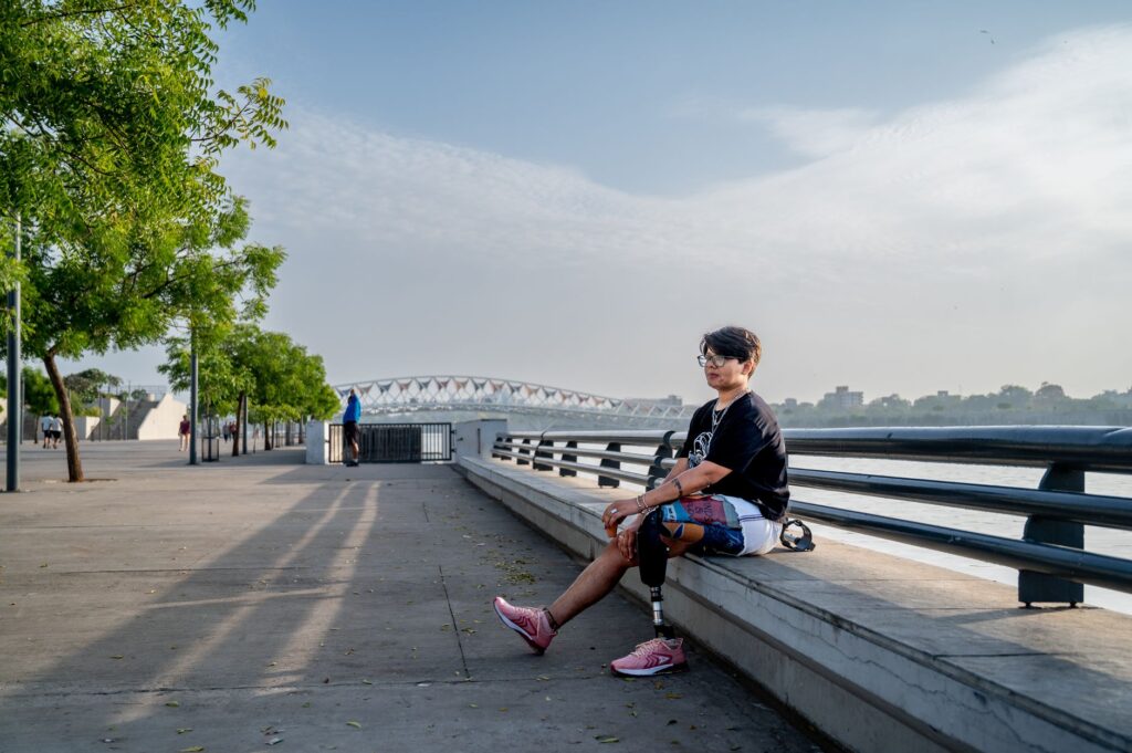 A person with a prosthetic leg relaxes by the riverfront in Ahmedabad, India, on a sunny day.